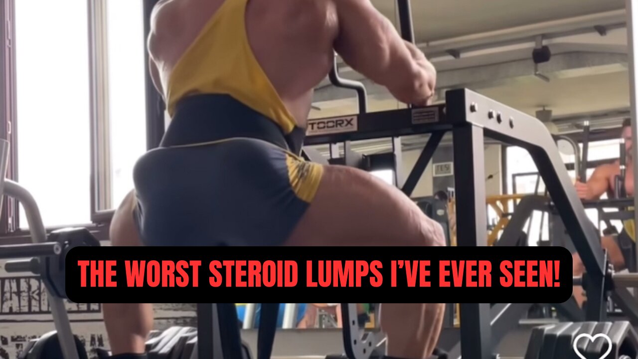 The Worst Steroid Lumps I've Ever Seen PLUS Live Q&A!