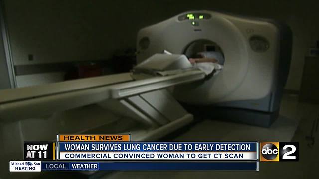 CT scan helps local woman detect lung cancer early
