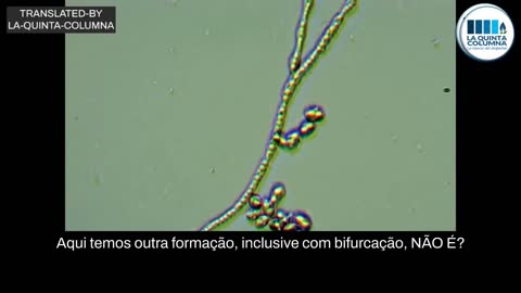 Análise de uma "vacina" Pfizer: Grafeno e nanotubos de carbono