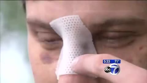 Racist Black man brutally beat up White man on New York bus