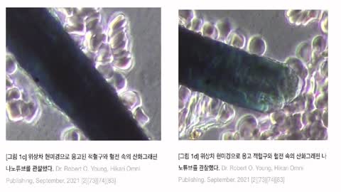 백신안에 뭐가 들엇네요? 이게 대체 뭐죠?