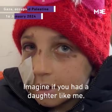 Wounded Palestinian girl: No one gives us anything
