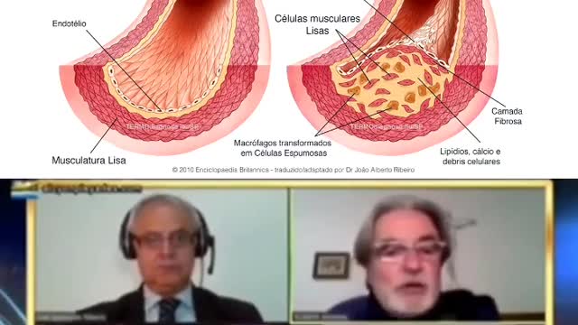 Endotelite