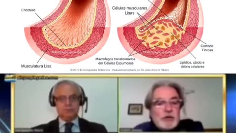 Endotelite