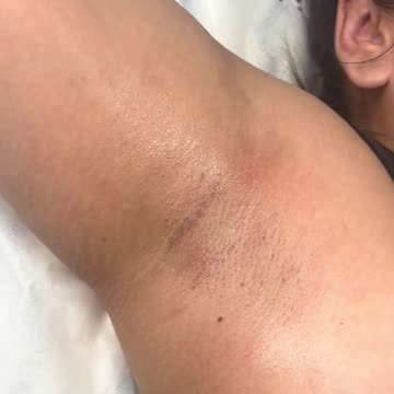 Underarm Waxing with Sexy Smooth Tickled Pink Hard Wax | Presented by Divine Esthetician