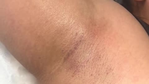 Underarm Waxing with Sexy Smooth Tickled Pink Hard Wax | Presented by Divine Esthetician