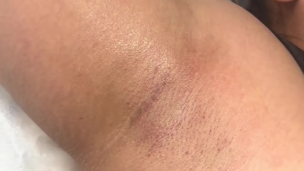 Underarm Waxing with Sexy Smooth Tickled Pink Hard Wax | Presented by Divine Esthetician
