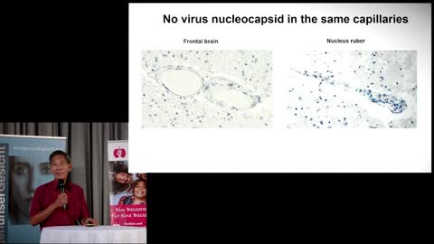 ICIC_Suddenly_changed_Personality_changes_after_mRNA_Injection