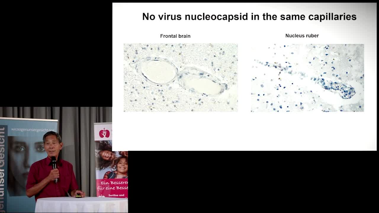 ICIC_Suddenly_changed_Personality_changes_after_mRNA_Injection