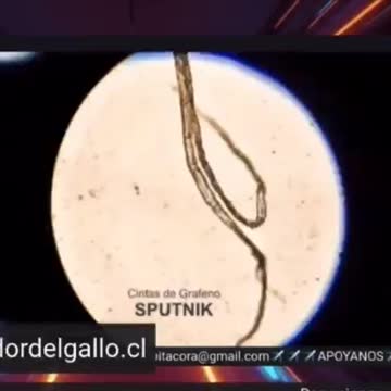 Anche dentro al vaccino SPUTNIK....🤔