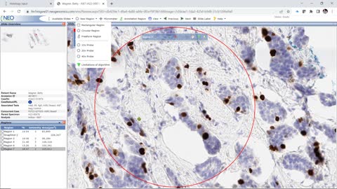 breast, image analysis