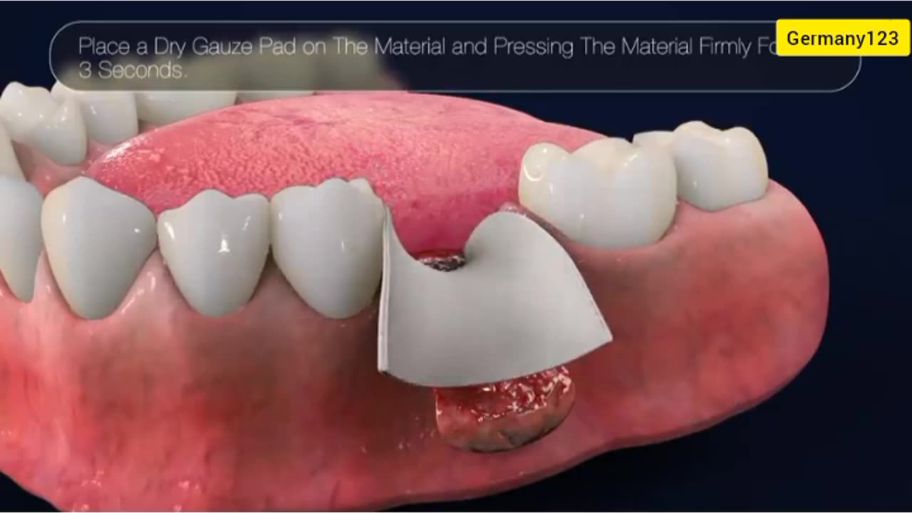 3D medical vedio