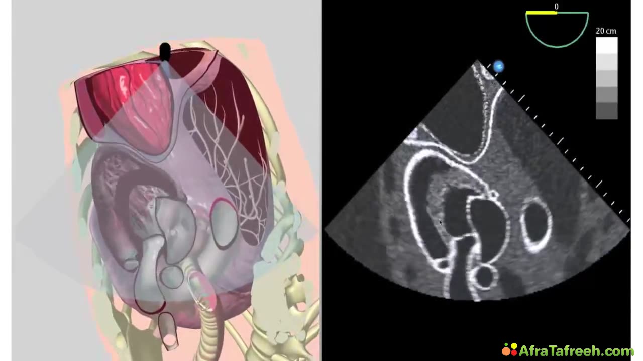 2. Imaging 2. Imaging - Cut Planes Part 2 atf