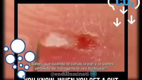 HOW HYDROGEN PEROXIDE 🤔FIGHTS DISEASE