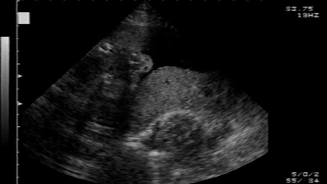 Ultrasound Of Savannah