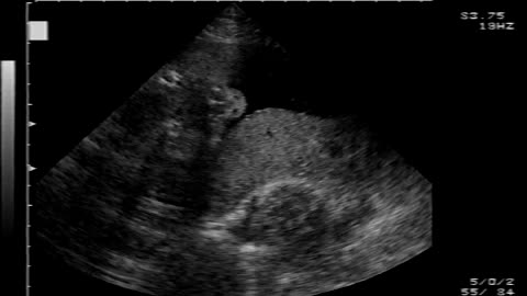 Ultrasound Of Savannah