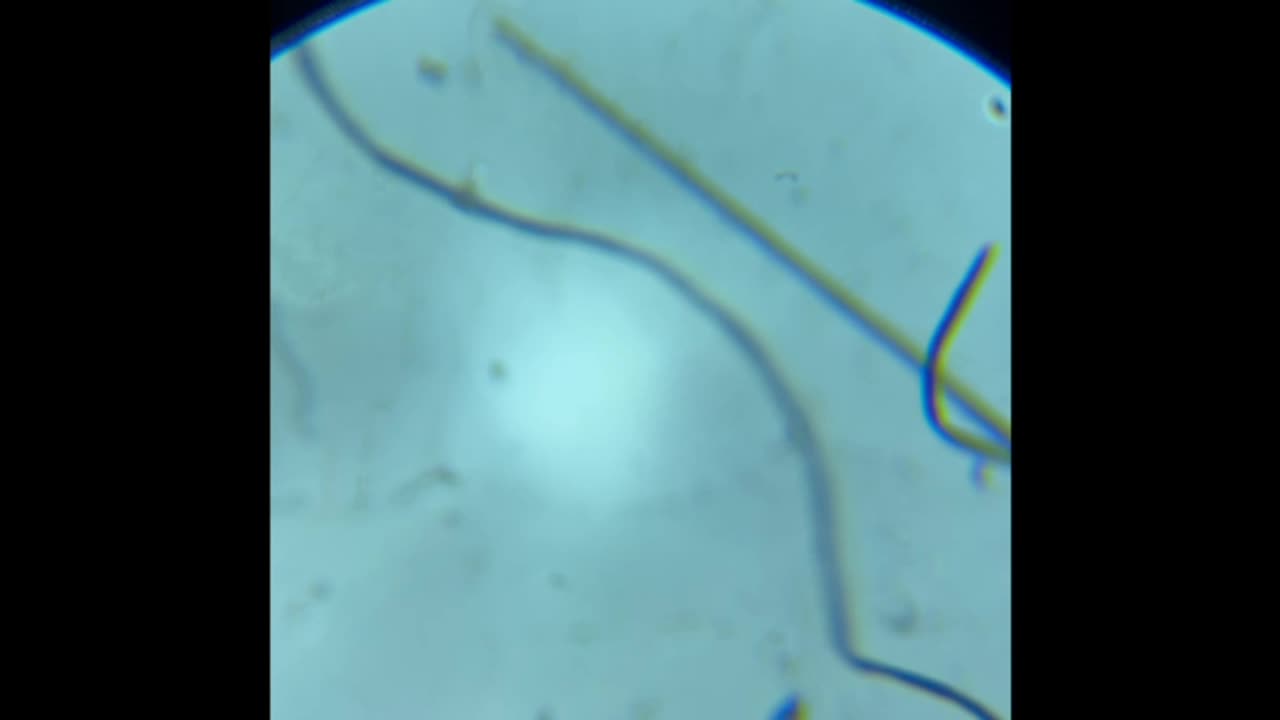 OMG!! PARASITES IN MY TAP WATER- IN ENGLAND?!! 29 FEB '24