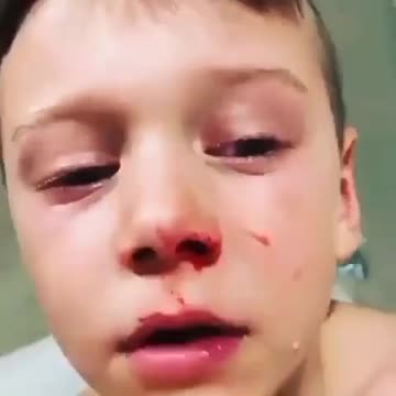 BLOODY HOTEL QUARANTINE IN AUSTRALIA