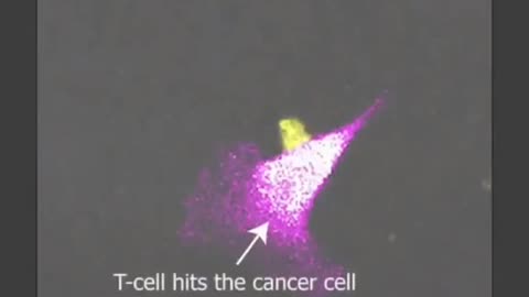 TCell Attacks And KiIIs #Cancer Cell