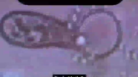 Cancers Being Healed Via Harmonic 11th Frequency