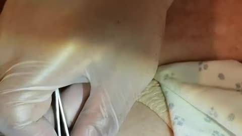 Big Blackhead