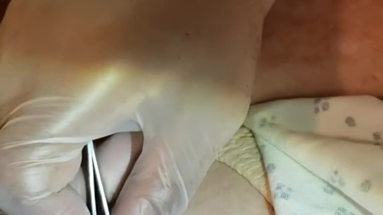 Big Blackhead