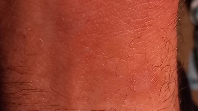 What is it?