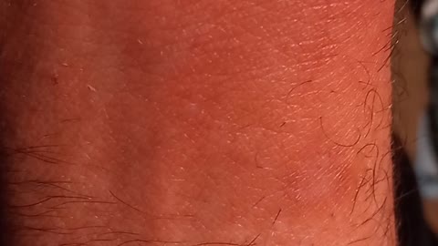 What is it?