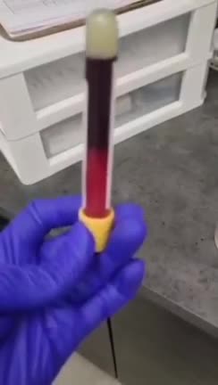 Ilyen az oltottak vére / This is the blood of the vaccinated