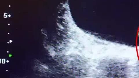 (radiology78) youtube instagram twitter twitch tiktalk dailymotion rumble