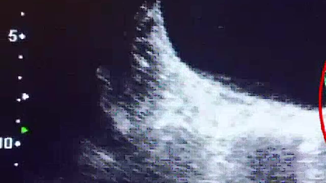 (radiology78) youtube instagram twitter twitch tiktalk dailymotion rumble