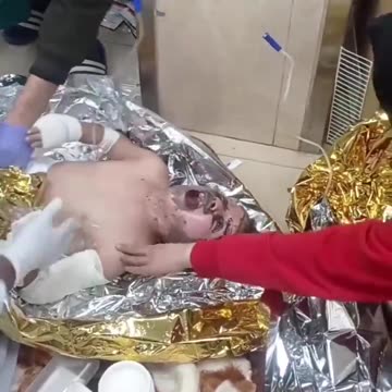 injured child from gaza