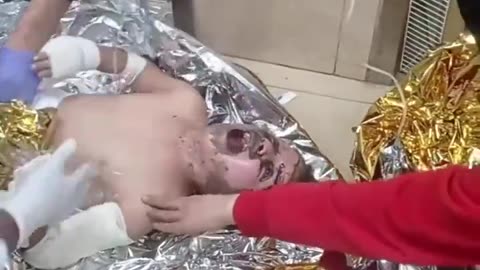 injured child from gaza