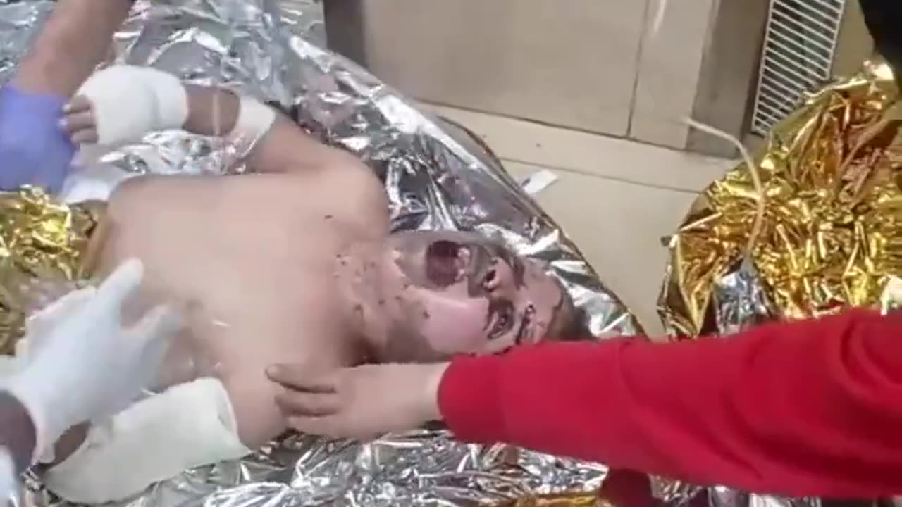 injured child from gaza