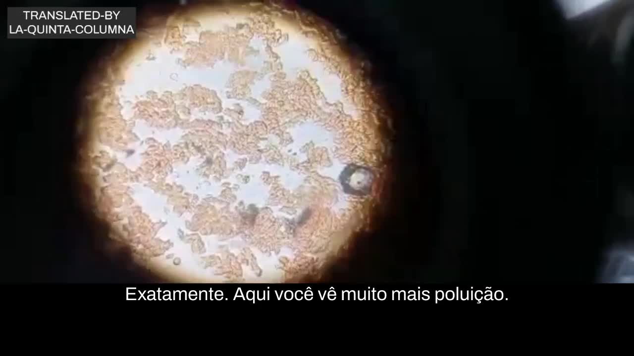 Olhem O QUE ESTA NO SANGUE DE QUEM LEVOU A ASTRAZENECA E SPUTNIK