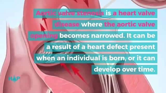 Risk Factors And Causes Of Left Ventricular Hypertrophy