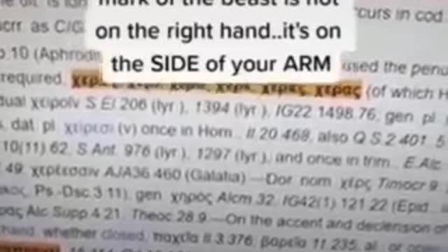 It's Not The Right Hand, It's The Right Arm!!!