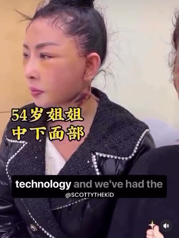 Chinese womens get face transplants from childs? [WTF is goin on)