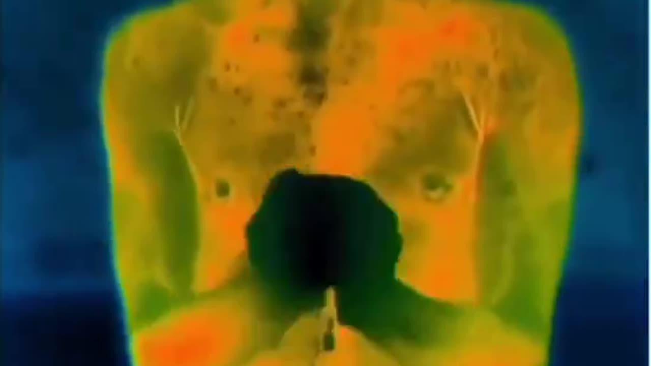 Hermal Camera shows how body loses heat in the cold