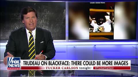 Tucker: Canadian Prime Minister Trudeau slammed for instances he wore blackface