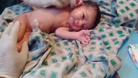 New born baby came with huge amount of meconium clean baby with baby oil baby is so beautifull