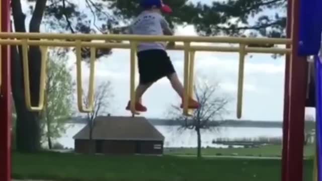 A 4-year-old Falls Hard On Bar In The Playground