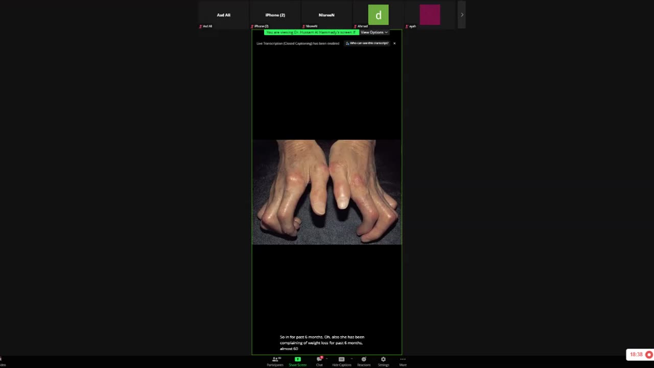 ST5.Lady with dysphagia