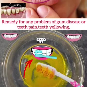 Remedy for any problem of gum disease or teeth pain,teeth yellowing