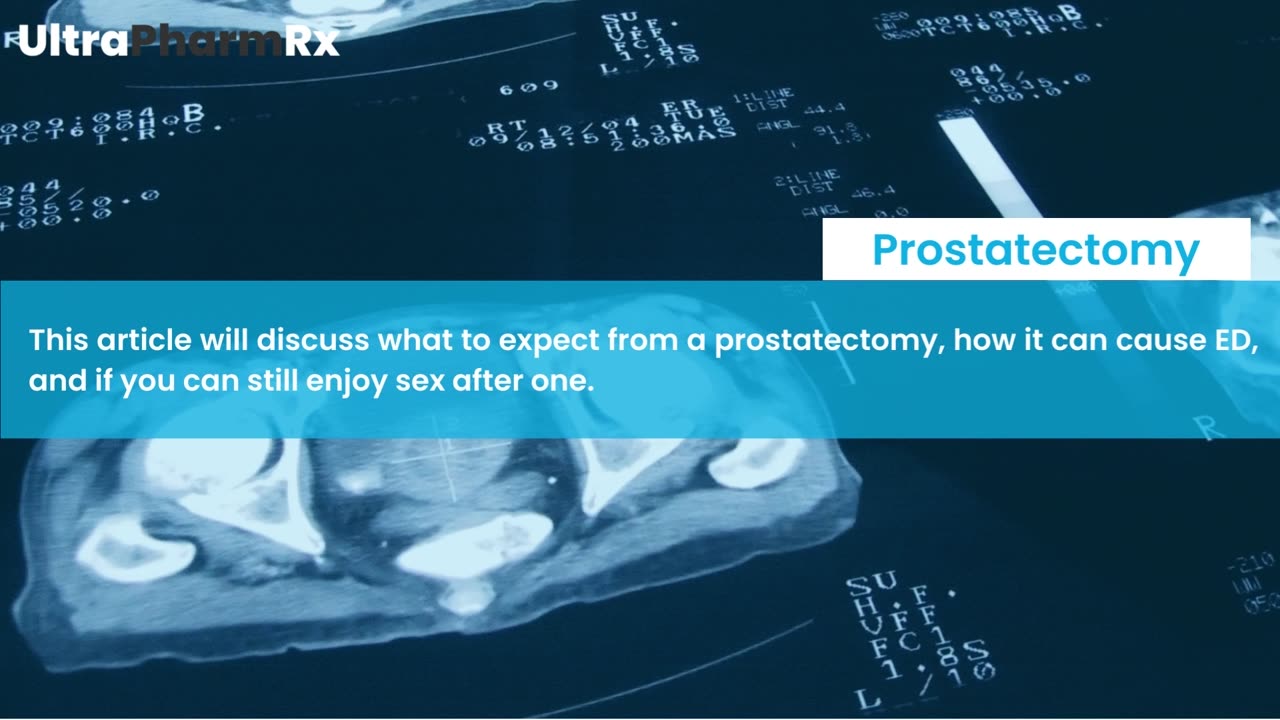 Sex After Prostatectomy: How Does Prostate Surgery Affect Your Sex Life?