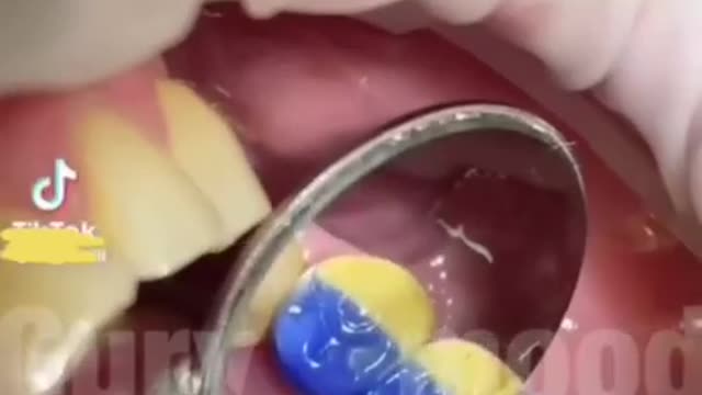 Ukrajina až do posledníhu zubu