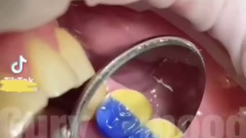 Ukrajina až do posledníhu zubu