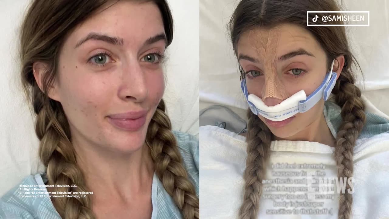 Charlie Sheen’s Daughter Sami SHARES New Plastic Surgery Procedure Results