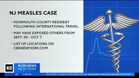 Monmouth County resident infected with measles in New Jersey’s first case