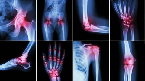 Dr. Mandell on Super Miracle Enzyme for Scar Tissue, Arterial Plaque, Breast Cyst, Painful Joints